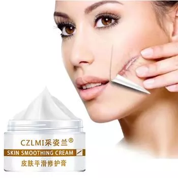 5 г/15 г/30 г/50 г/крем для восстановления шрамов для осветления шрамов, крем для восстановления шрамов при хирургии беременности, разглаживающий крем для ухода за кожей 5g