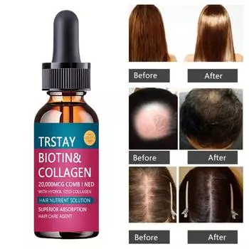 5 мл/15 мл/30 мл/50 мл/новые средства для роста волос с имбирем, эфирное масло для быстрорастущих волос, предотвращающее выпадение волос, масло для лечения кожи головы для мужчин, женщин 5ml