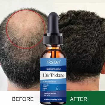 5 мл/15 мл/30 мл/50 мл/женское средство против выпадения волос, масло розмарина, профессиональное чистое касторовое масло, масло для ресниц, рост волос, бровей 5ml