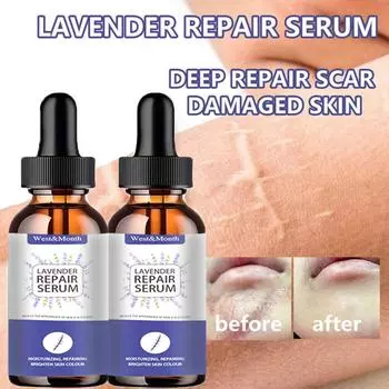 5 мл/15 мл/30 мл/50 мл/женский отбеливающий крем для лица, крем для темной кожи, пятна, шрамы, дневной ночной крем для лица, отбеливание кожи, корейские средства по уходу за кожей 5ml