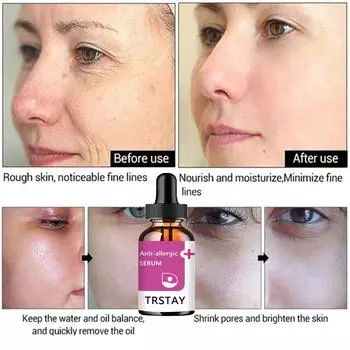 5 мл/15 мл/30 мл/50 мл/эссенция для лица из белого риса Эссенция с гиалуроновой кислотой Сужает поры, уменьшает тонкие линии, питает кожу, очищает грязь на лице 5ml