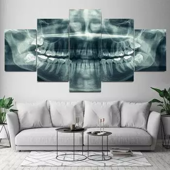 5 панелей, рентгеновские снимки зубов, стоматолога, холст, картина, постеры и принты для здоровья и медицины, настенные художественные фотографии, домашний декор, без рамки 20x35cm*2 20x45cm*2 20x55cm*1