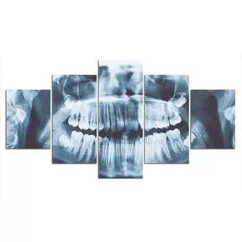 5 шт., рентген зубов, стоматологический декор, 5 шт., фотографии, настенный постер, домашний декор, 5 панелей, декор комнаты, современное абстрактное искусство, без рамки 20x35 20x45 20x55cm