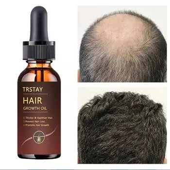 5G/15G/30G/50G/ Помогает восстановить фиброзную ткань и восстанавливает жизненную силу волос.. Содержит питательные вещества 5ml