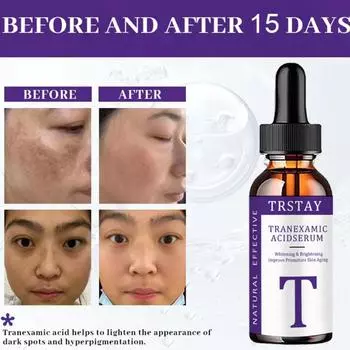 5G/15G/30G/50G/TRSTAY Витамин C для крема для лица, пигменты, удаление темных пятен, отбеливающий крем для лица, осветляющие средства по уходу за кожей, красота, здоровье 5ml