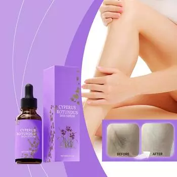 60 мл Лосьон после бритья Питает кожу и снимает дискомфорт для предотвращения «клубничной кожи» и выпадения волос One Size