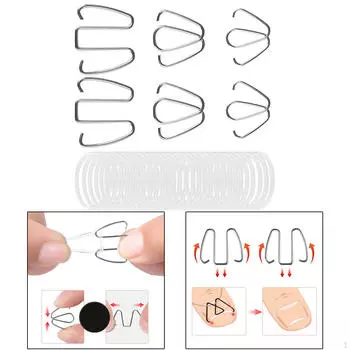 6x проволочных инструментов для коррекции вросших ногтей на ногах, облегчающих дискомфорт с 30 резиновыми кольцами, фиксатором ногтей