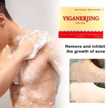 80 г серного мыла, натуральное, мягкое, эффективное, безопасное, не раздражающее очищающее средство для кожи, для контроля жирности и очищения пор 80 g