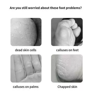 8 шт. шлифовальная машина для ног для удаления омертвевших мозолей, домашний педикюр, бритье ног, шлифовальная доска, набор инструментов для педикюра