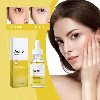 Advanced Deep Skin Care, ежедневный лосьон для кожи лица, лосьон для лица, лосьон для подтяжки пор для всех типов кожи 30 мл One Size