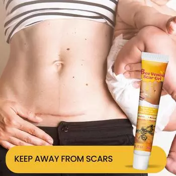 Advanced Scar Gel, бальзам для ухода за кожей Inhibition, подходит для ожогов, женщин, мужчин, лица, рук, ног и тела белый