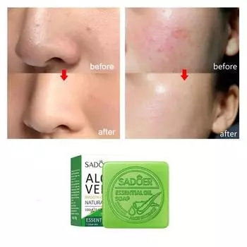 Алоэ Вера, гладкое очищающее средство для лица, натуральное мыло, очищающее поры, мыло с эфирным маслом 100g