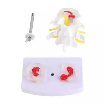 Анатомическая демонстрационная модель поясничной грыжи позвоночника человека, школьные учебные принадлежности