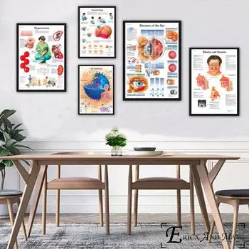 Анатомические заболевания, патология, холст, плакат, украшение для гостиной, безрамное настенное изображение 21cm30cm NoFrame