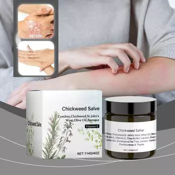 Anesis Dry Red, зудящий и неприятный лосьон для ухода за зудом кожи One Size