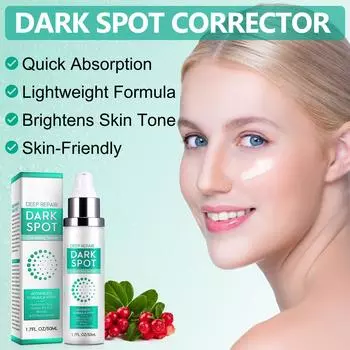 Anti-freckle Cream 50ml Control Pigment Reflux, Inhibits Melanin, Prevent Anti-blackening, Repairs Skin, Moisturizes And Hydrates One Size