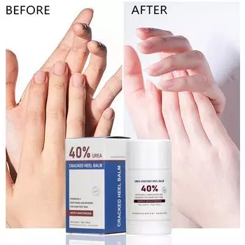 Бальзам-карандаш с мочевиной 40 процентов, бальзам для пяток, бальзам-карандаш для рук с мочевиной и бальзам-карандаш для ног для увлажнения и сухой потрескавшейся кожи, потрескавшейся пятки, предотвращения обморожения(30г) белый