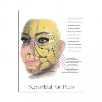 Beauty Syringe Female Facial Anatomy and Physiology Muscle Vascular and Fat Pad Dermal Filler and Botox Salon Poster Home Decor 21cm30cm NoFrame