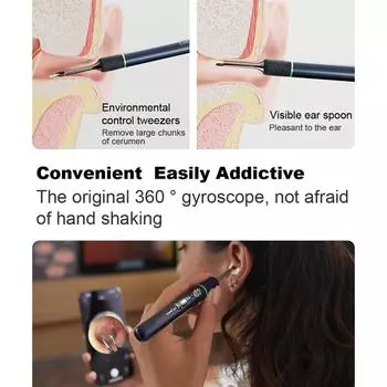 Bebird Note5 Pro Ear Cleaner Smart Visual Удаляющие палочки для ушной серы HD Эндоскоп Пинцет Мини-камера для чистки ушей Отоскоп белый