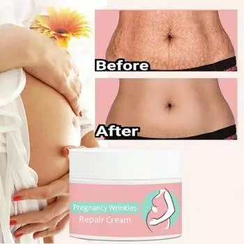 Беременность, укрепляющий восстанавливающий крем для кожи после беременности 5G