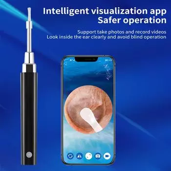 Беспроводной Wi-Fi эндоскоп для удаления ушной серы с камерой 3,9 мм, 350 Вт, 6 интеллектуальных светодиодных фонарей 0 чёрный