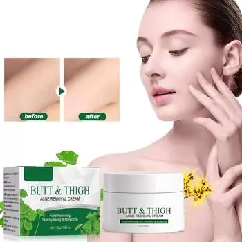 Body Acne, Skin Acne Plant Extracts Are Gentle Acne And Acne-free, Skin Smoothing Care, Gentle And Non-irritating,3.99fl.oz/110g One Size белый