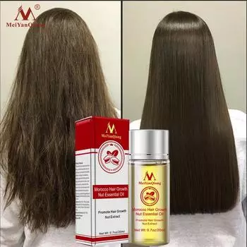 Быстрая мощная эссенция для роста волос, эфирное масло, жидкое лечение, восстановление волос, средства по уходу за волосами