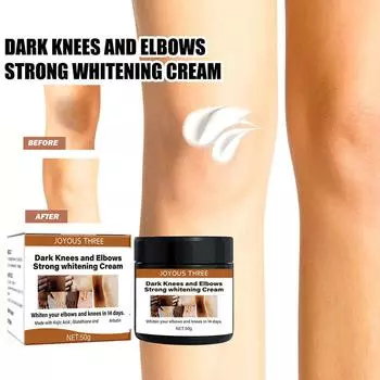 Быстро отбеливающий крем для темных костяшек пальцев, корректор пигментации кожи, черный крем для рук, пятна Elb H9E9 white-50g