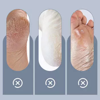 Бытовой регулируемый электрический инструмент для удаления мозолей на ногах, водонепроницаемый шлифовальный инструмент для ног, инструменты для педикюра, сухой омертвевшей кожи белый