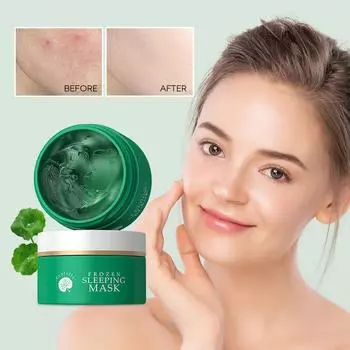 Centella Asiatica Acne Face Cream Удаление прыщей Контроль жирности Увлажняющий Pockmark Smooth Facial Creams Средства по уходу за кожей зелёный