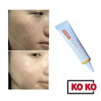 [ЧАКАН] Крем Vita Real (Осветление и отбеливание) 15 мл для улучшения веснушек 15ml x 1