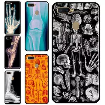 Чехол для телефона с рентгеновской анатомией человека для OPPO A15 A3S A5S A52 A72 A54 A74 A94 A83 A91 A93 A5 A9 A31 A53 A53S 2020 OPPO A15