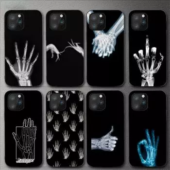 Чехол для телефона X Ray Hand Bones для Iphone 11 12 Mini 13 14 Pro Xs Max X 8 7 6s Plus 5 Se Xr Shell iPhone13PROMAX
