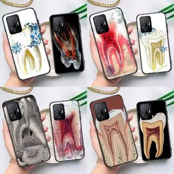 Чехол с изображением анатомии человеческого зуба для POCO F5 X5 X3 Pro X4 F4 GT F3 M5s C40, чехол для Xiaomi 13 12 Lite 11T 12T Pro 12X POCO X3 Pro