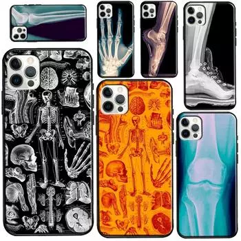 Чехол с рентгеновским изображением анатомии человека для iPhone 12 Pro Max 13 mini для iPhone XR XS X SE 2020 7 8 Plus 11 Pro Max iphone 5 5S SE
