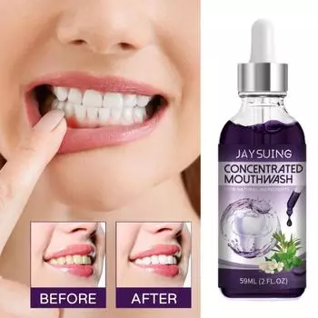 Чистый рот, профилактика кариеса, безопасная 59 мл, концентрированная жидкость для полоскания рта против кариеса и укрепления зубов 59ML