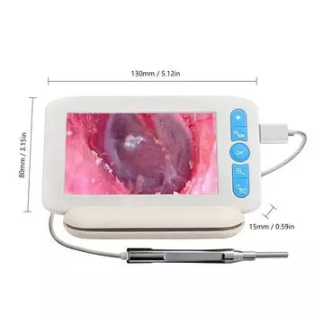 Цифровой отоскоп с 6 светодиодами, 32G TFcard, 3,9 мм, 1080P, камера для наблюдения за ушами, 4,3 дюйма белый