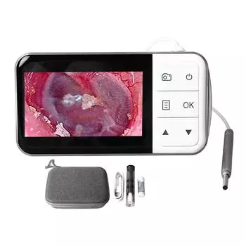 Цифровой отоскоп, визуальная удобная ушная камера, инструмент для удаления ушной серы с дисплеем 4,5 дюйма