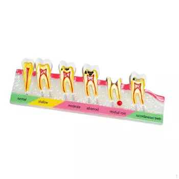 Демонстрационная модель зубов Образовательный стандарт для школьников Style A