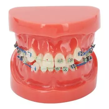 Dental Model Metal Wires 24 Teeth Half Metal Half Ceramic Bracket Tooth Correct Model for Study