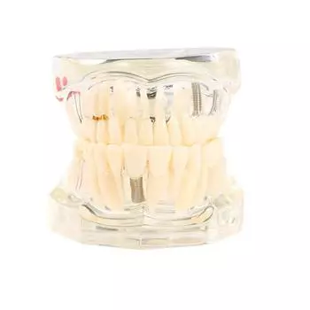 Дентальные модели Съемные и восстанавливаемые модели больных зубов для обучения и исследования медицинских и стоматологических заболеваний синий