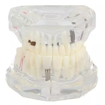 Dental Study Transparent Teeth Model Dental Laboratories Learning Teaching Teeth Model