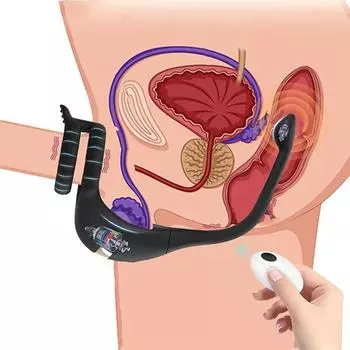 Двойное кольцо, двойной шок, блокирующее кольцо со спермой, анальная пробка, вибратор для пары, секс-игрушки, кольцо для пениса с дистанционным управлением, товары для взрослых