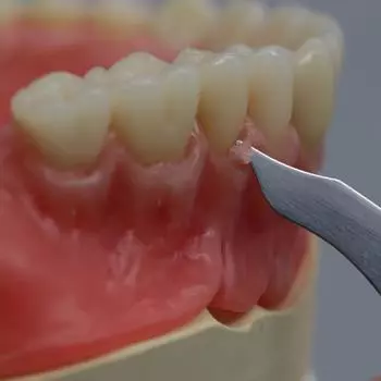 Двусторонний нож для резьбы по воску Ложка для резьбы из нержавеющей стали Стоматологическое лабораторное оборудование Инструмент для рукоделия Стоматологические материалы