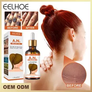 EELHOE 50 мл Отбеливающая сыворотка от темных костяшек пальцев Осветляющая сыворотка от темных коленей и локтей Крем от темных пятен Масло для тела Осветляющий меланин Уход за телом