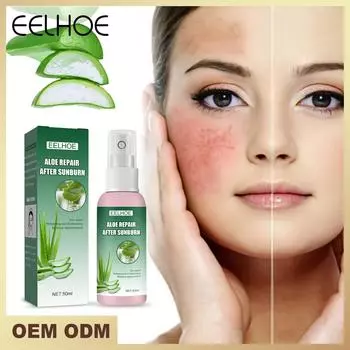 Eelhoe After Sun Repair Essence Oil, успокаивающее, увлажняющее, устраняющее покраснения кожи, солнцезащитный крем для лица, средство для ухода за телом от солнечных ожогов, 50 мл