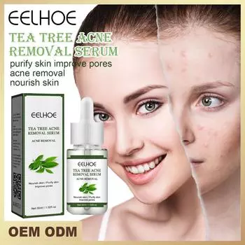 EELHOE чайное дерево против прыщей сыворотка для лица контроль масла сужение пор сыворотка от прыщей против прыщей отбеливание шрамов от прыщей удаление сыворотки для ухода за кожей 30ml