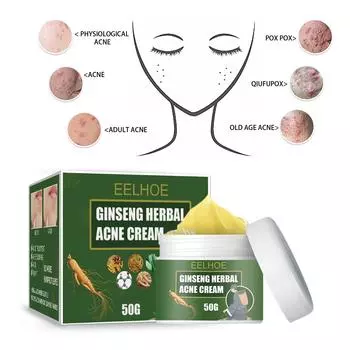EELHOE Herbal Acne Clearing Cream Acne Removal Fading Acne Marks Hydrating Cleansing Cream Oil Balancing Acne Removal Cream 50g
