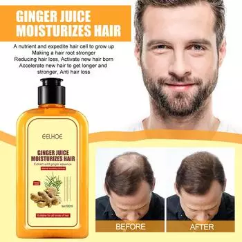 EELHOE Имбирный шампунь против вырождения и зуда, крем-кондиционер для волос, против перхоти, контроль масла и против зуда, 100 мл 100ml