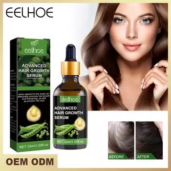 EELHOE Эфирное масло для роста волос имбиря, натуральные средства против выпадения волос, быстро растут, предотвращают облысение, зародышевая жидкость для мужчин и женщин, 30 мл 30ml